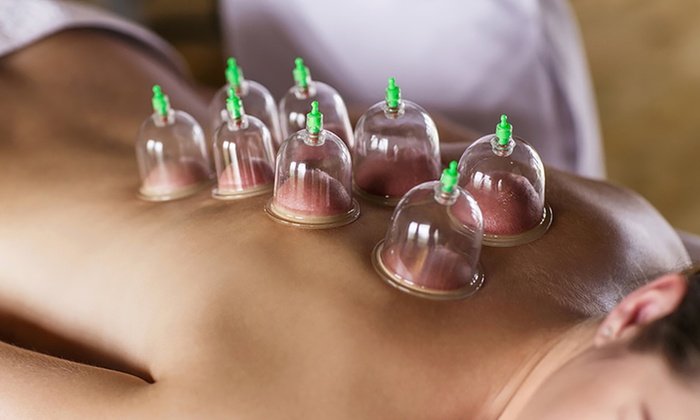 Ana's Spa Brisbane Treatment Highlight of the Week: Cupping